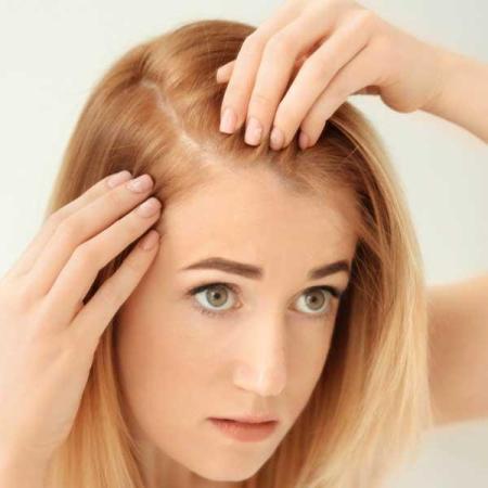 Causes of Hair Follicle Shrinkage