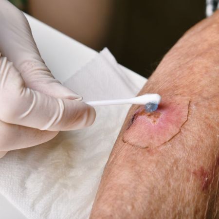 Skin Regeneration and Wound Repair