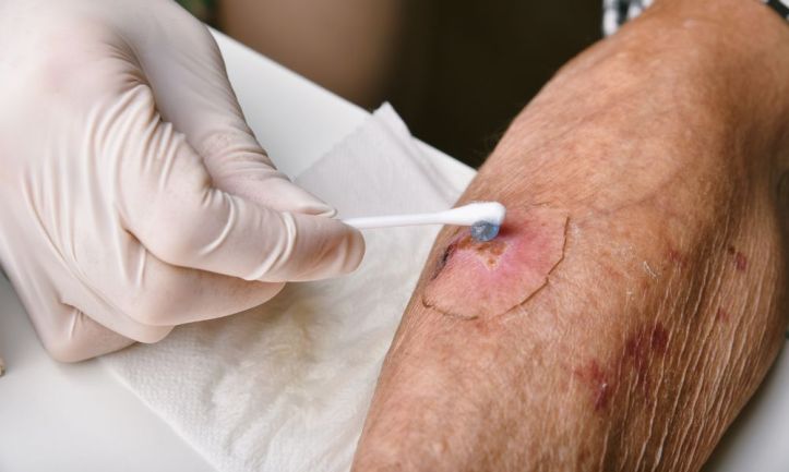 Skin Regeneration and Wound Repair